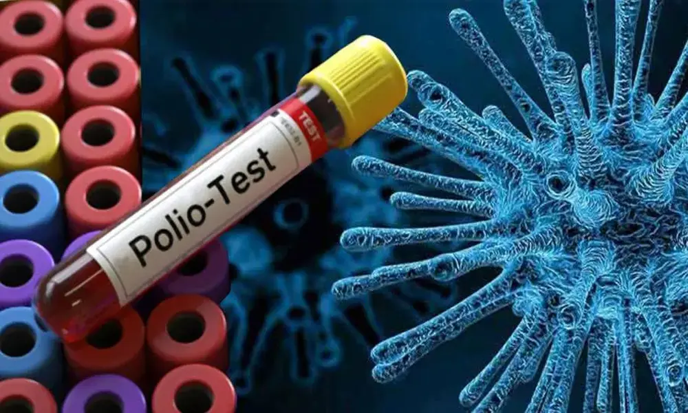 Polio Virus Resurfaces in 3 Districts of Khyber Pakhtunkhwa, NIH