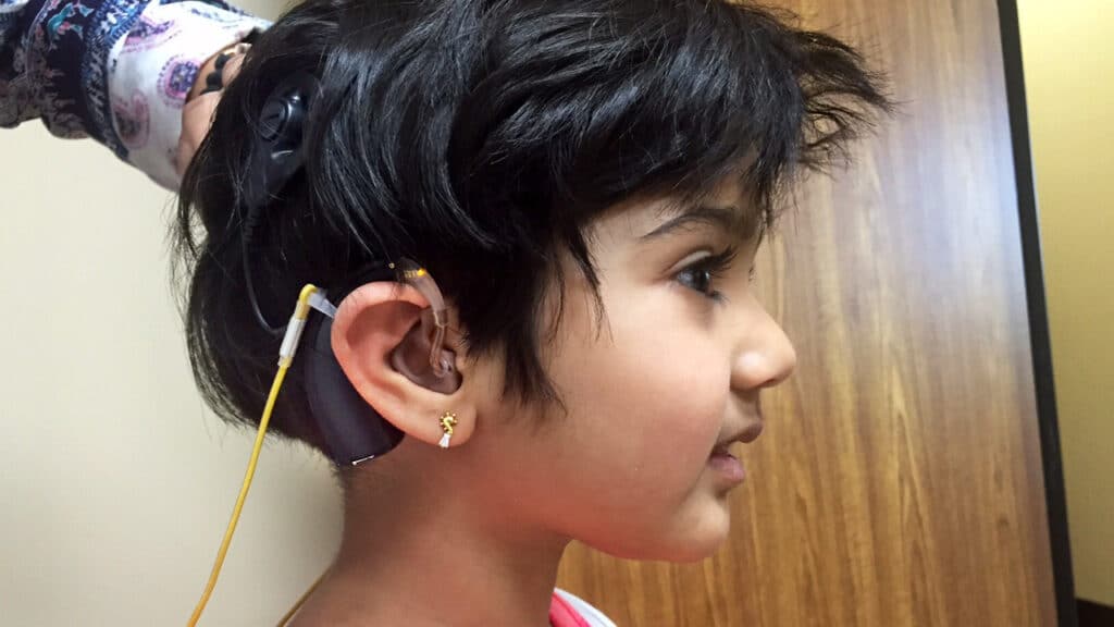 Cochlear Implant Programme