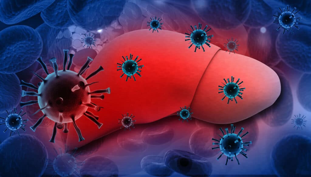 Hepatitis C