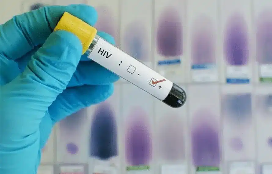 HIV cases